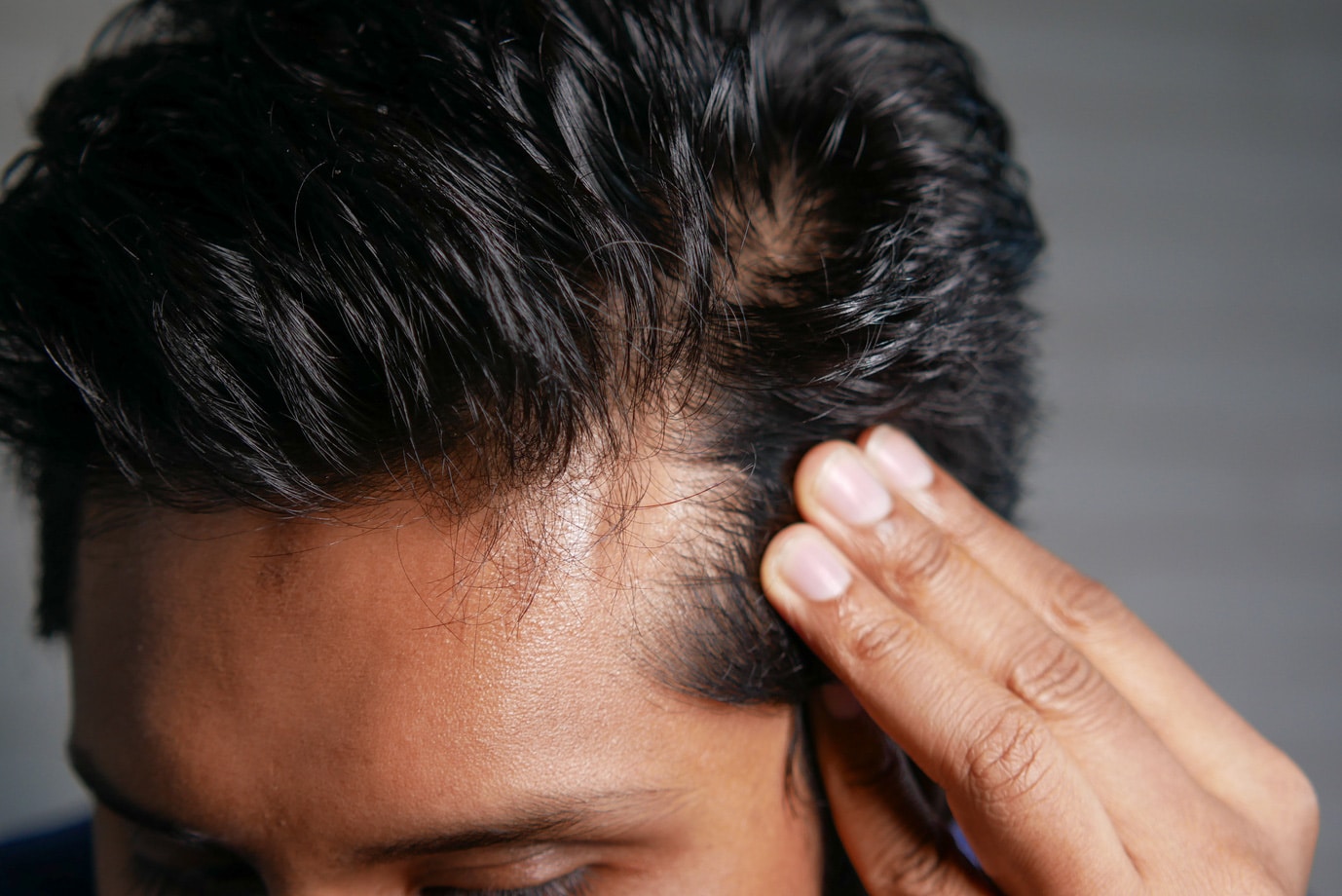 Hair Loss, Alopecia, and Scalp Health Solutions