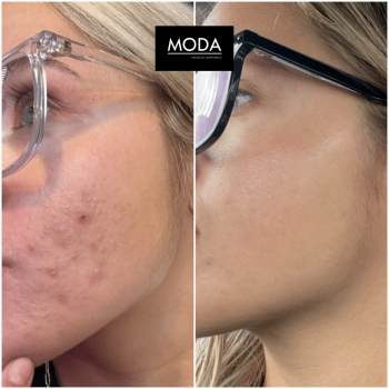 Skincare